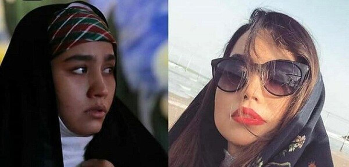 تغییر چهره «عطیه» سریال بچه مهندس ۳ در ۳۲ سالگی