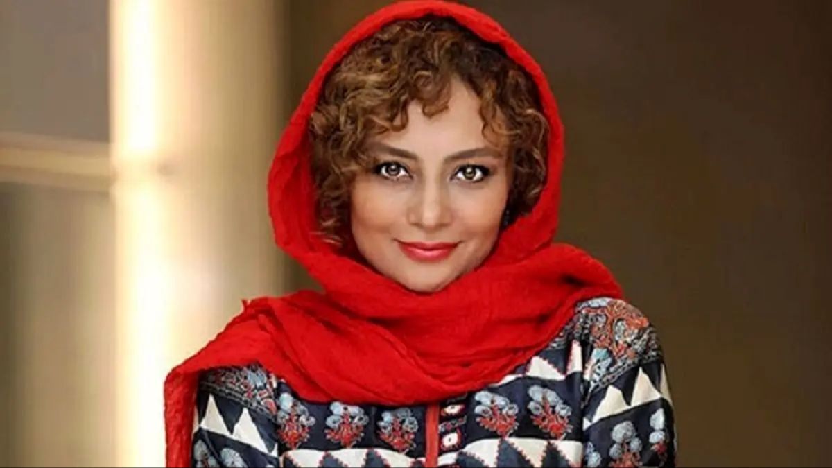 عکس یکتا ناصر بعد از عمل بینی 