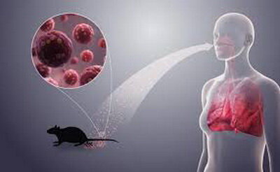 اطلاعات تازه درباره هانتاویروس
