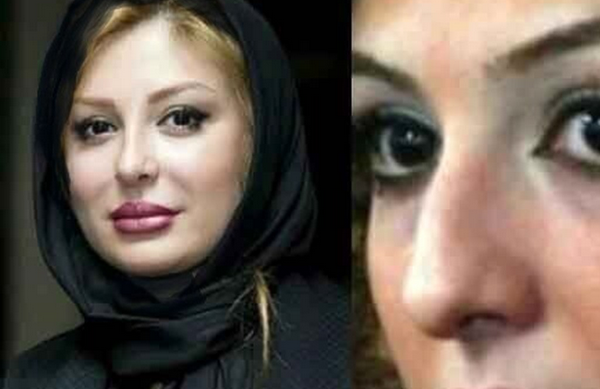 سفر در زمان؛ قبل و بعد عمل های زیبایی خانم بازیگران ایرانی/ از شیلا خداداد تا بهنوش طباطبایی!