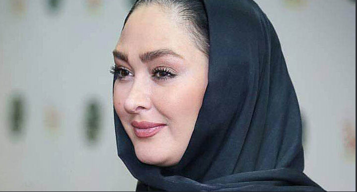 عکس/ محال است الهام حمیدی را با چهره جدیدش بشناسید