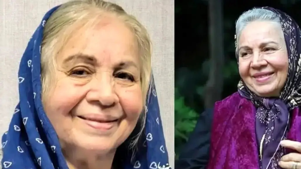 عکس/سفر در زمان؛ تغییر چهره شمسی فضل اللهی بازیگر سریال سه در چهار بعد از گذشت ۱۷ سال