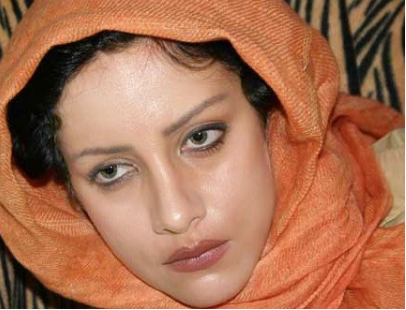 چهره ترسناک شراره رخام بعد از تزریق زیاد ژل به لبهایش+ عکس