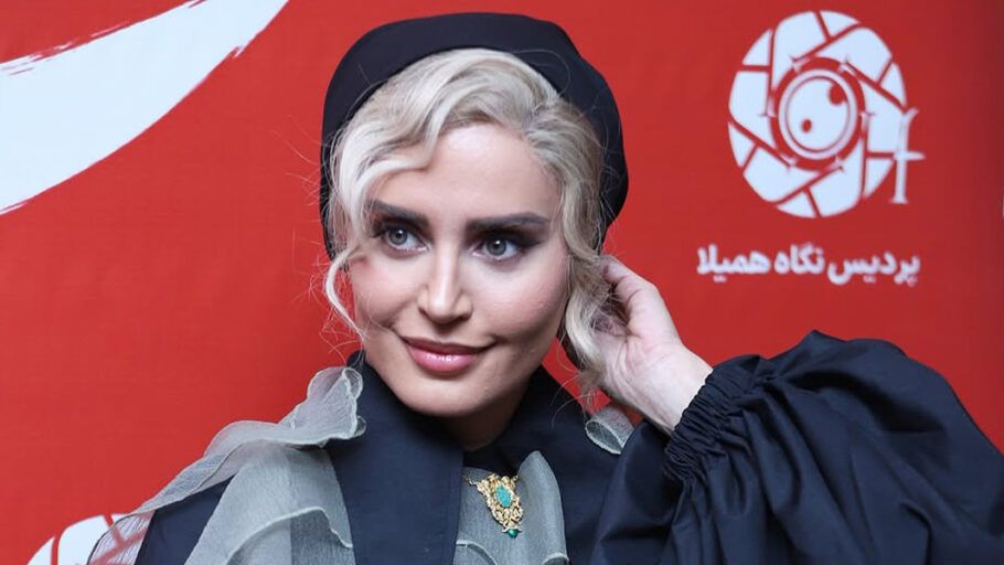 ماجرای تزریق کورتون به الناز شاکردوست هنگام فیلمبرداری یک فیلم سینمایی + تصاویر