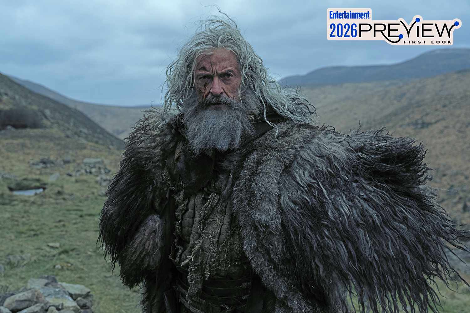 هیو جکمن در اولین تصویر از فیلم جدید «رابین هود» کاملاً غیرقابل تشخیص است