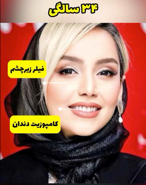 سیر تغییر چهره نازنین بیاتی