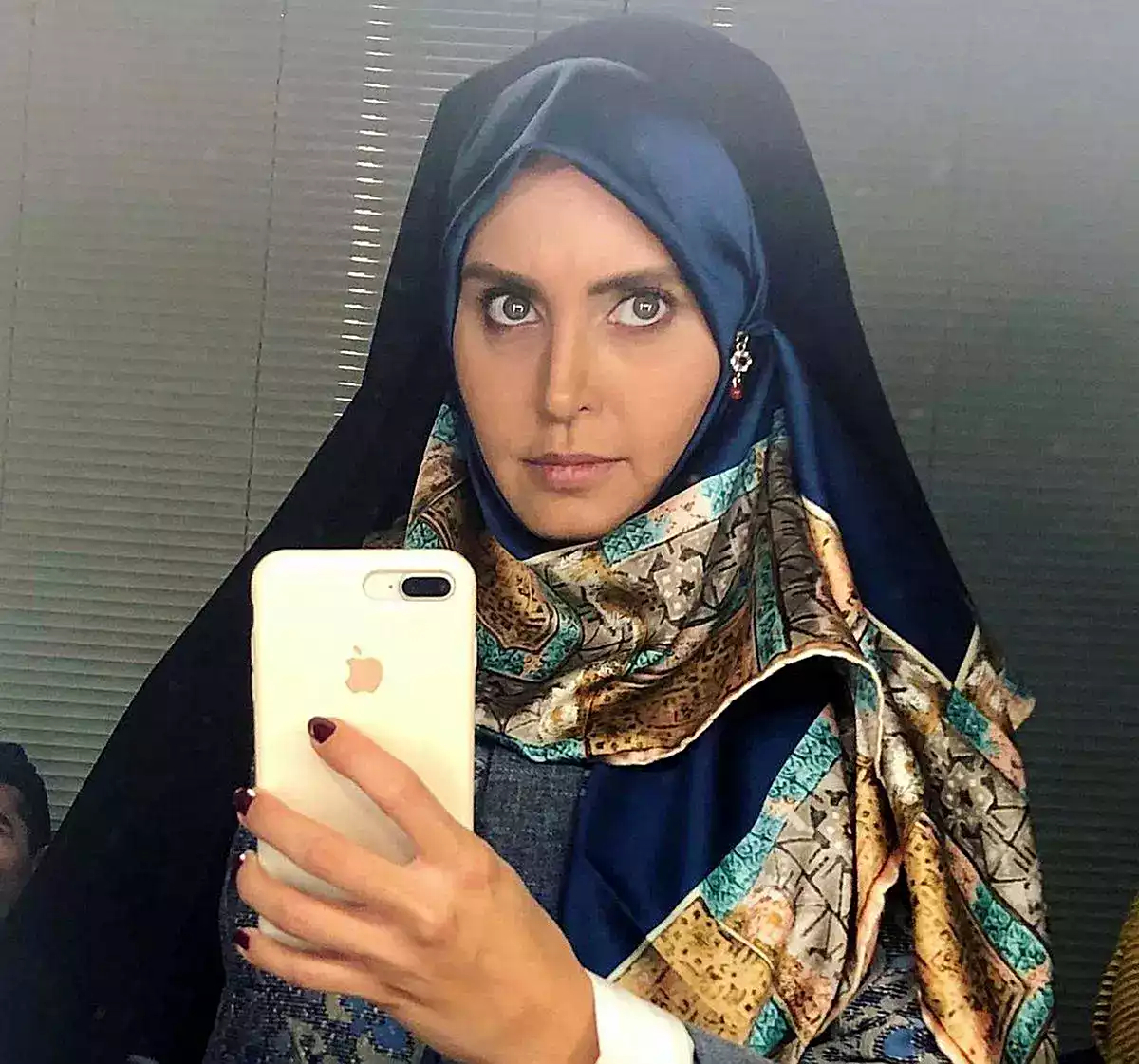 چهره غیرقابل باور الناز شاکردوست با موهای از ته تراشیده+ عکس